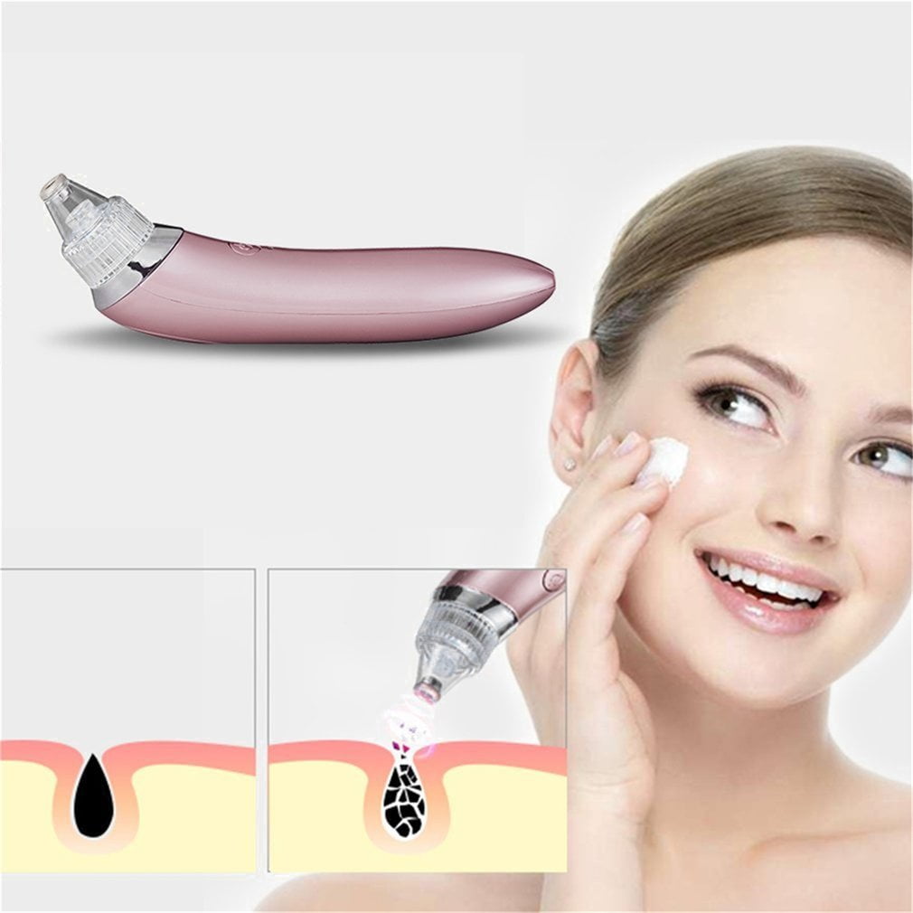 Portable Ultrasonic XN-8030 Electric Blackheads Suction Remover Clean Skin!F